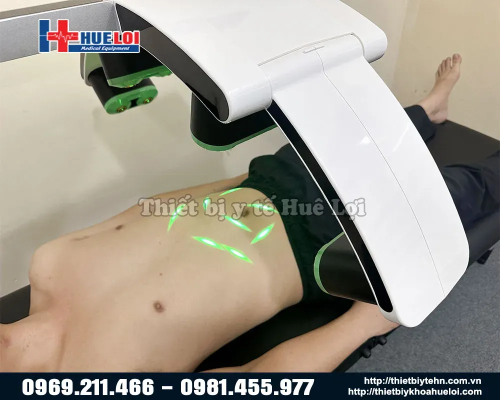 Điều trị giãm mỡ bụng bằng máy laser trị liệu tần số thấp