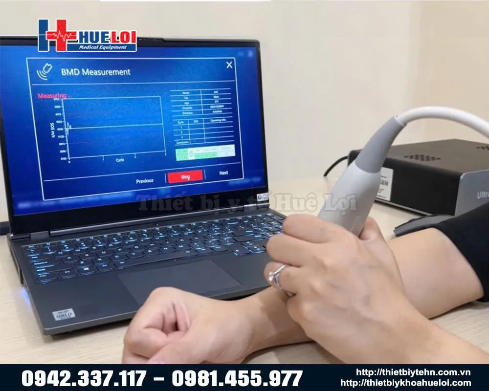 Hưỡng dẫn sử dụng máy đo loãng xương giá rẻ