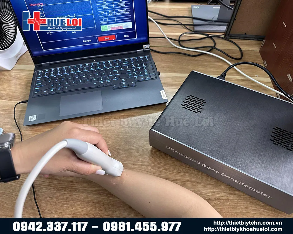 Sử dụng máy đo loãng xương giá rẻ