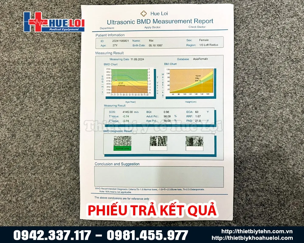 Phiếu trả kết quả của máy đo loãng xương giá rẻ