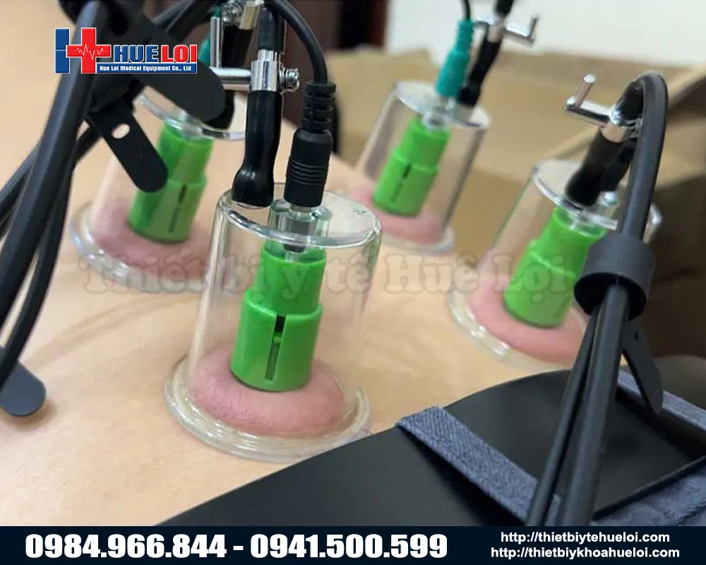 Điện châm kết hợp giác hút thế hệ mới nhất