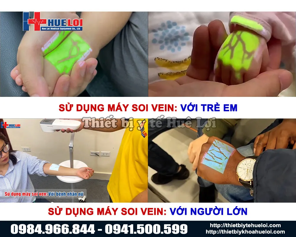 Máy chiếu tìm tĩnh mạch QV-600