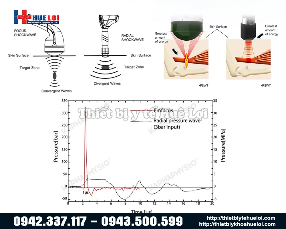 Sự khác biệt của hai cơ chế sóng xung kích hội tụ và sóng xung kích phân kỳ
