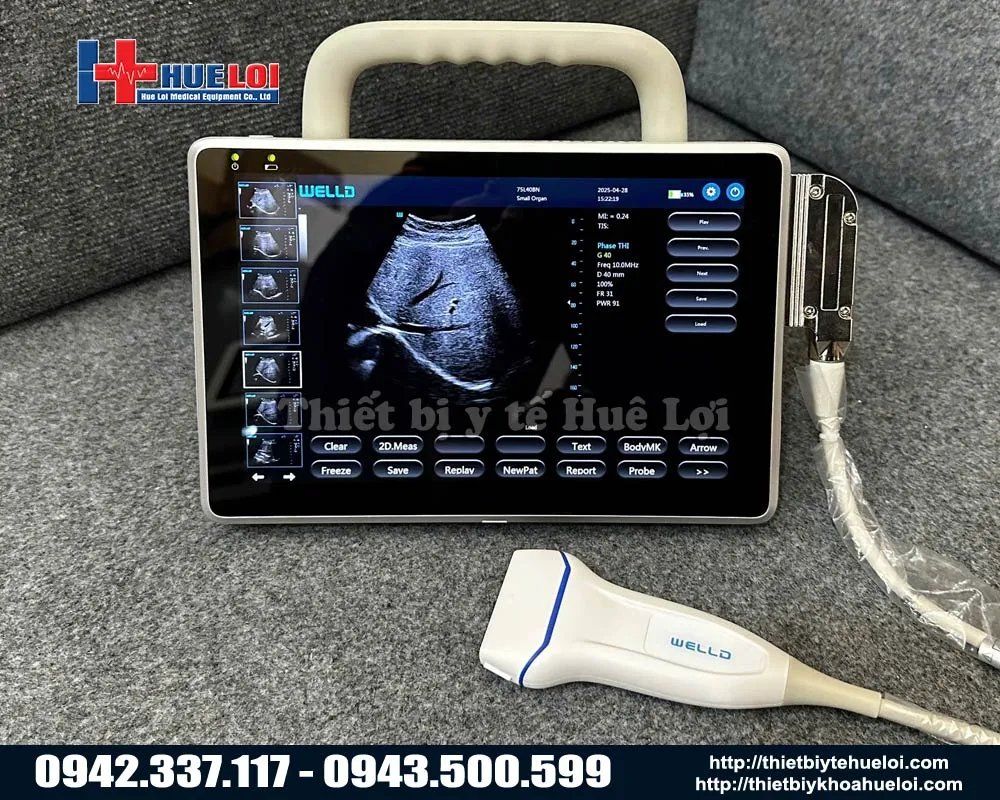 Máy siêu âm tổng quát xách tay hình ảnh 2D giá rẻ