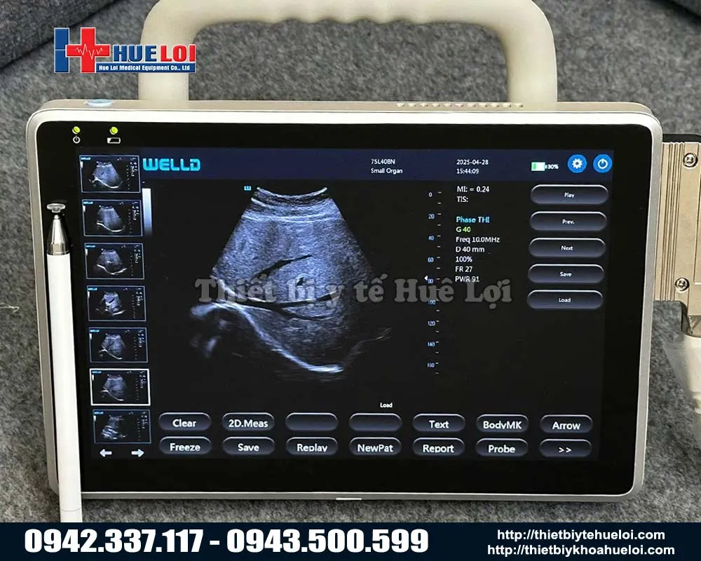 Máy siêu âm xách tay cảm ứng well.d p10