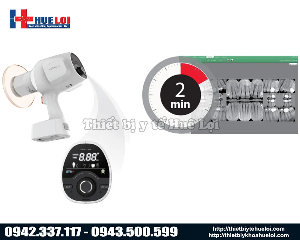 Tinh năng tối ưu thời gian chụp ảnh ở máy x-quang răng Vatech