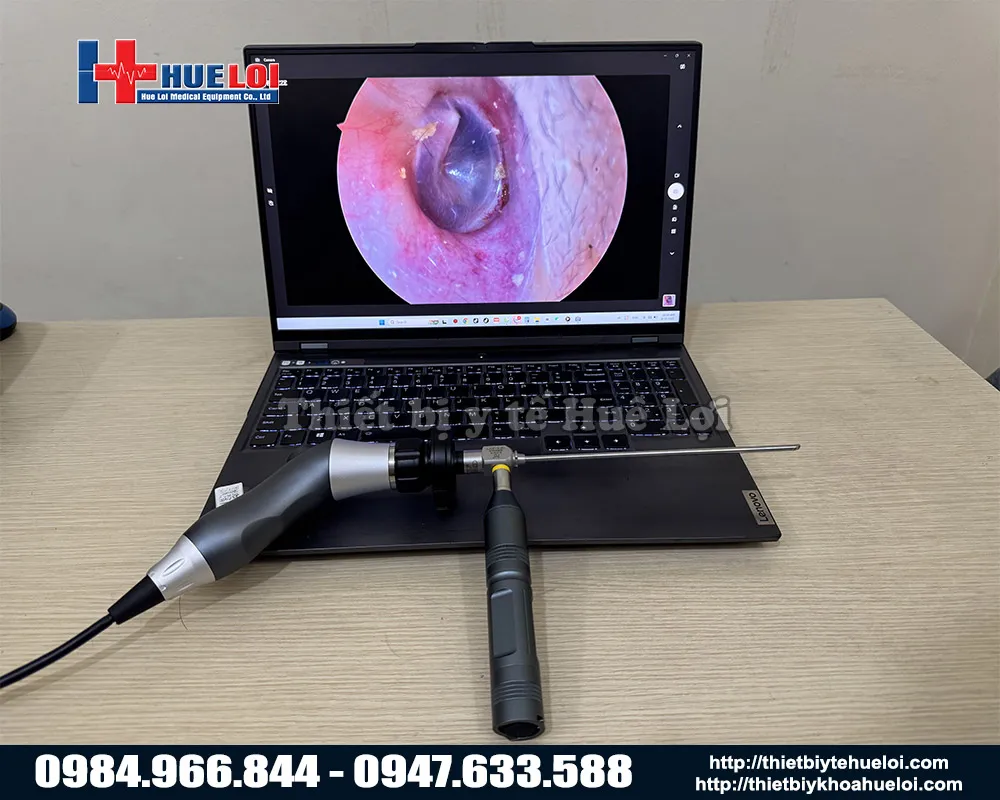 Máy nội soi tai mũi họng mini FULL HD