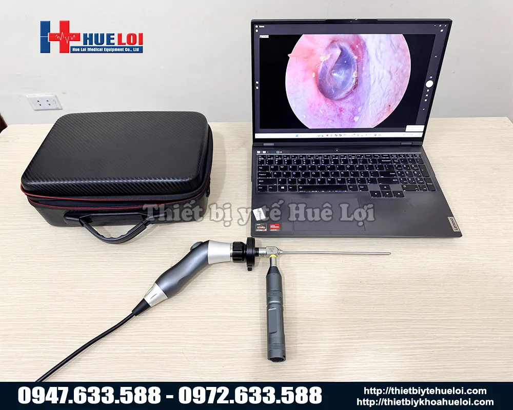Máy nội soi tai mũi họng xách tay full hd