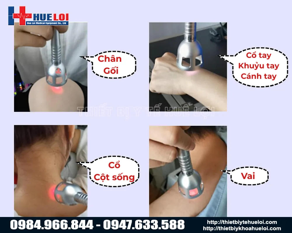 Ứng dụng của máy laser trị liệu texua giá rẻ