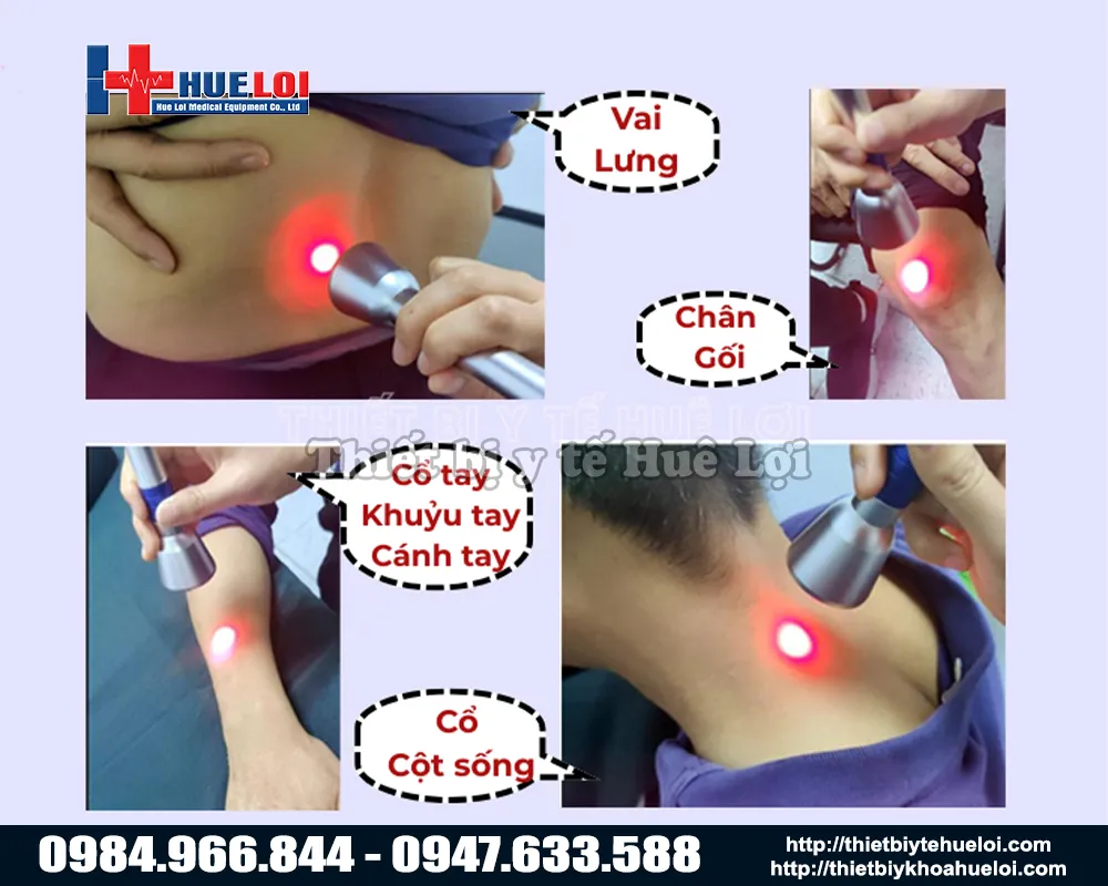 Ứng dụng máy laser trong trị liệu