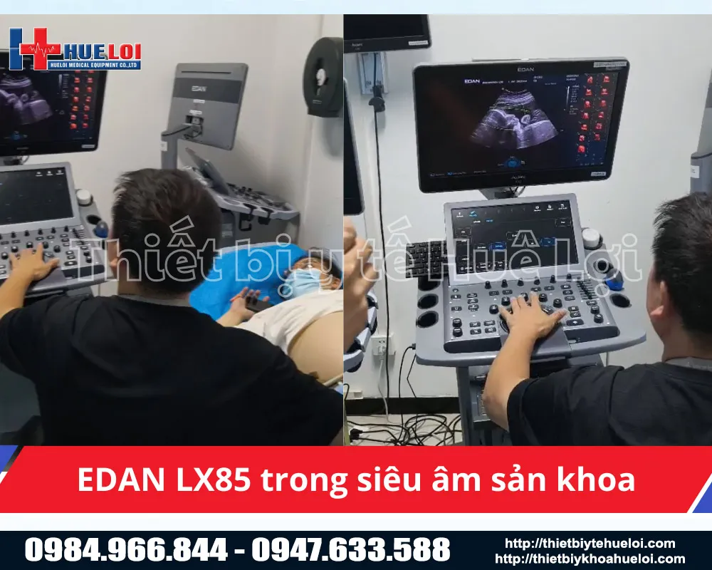 máy siêu âm 5D trong siêu âm sản khoa