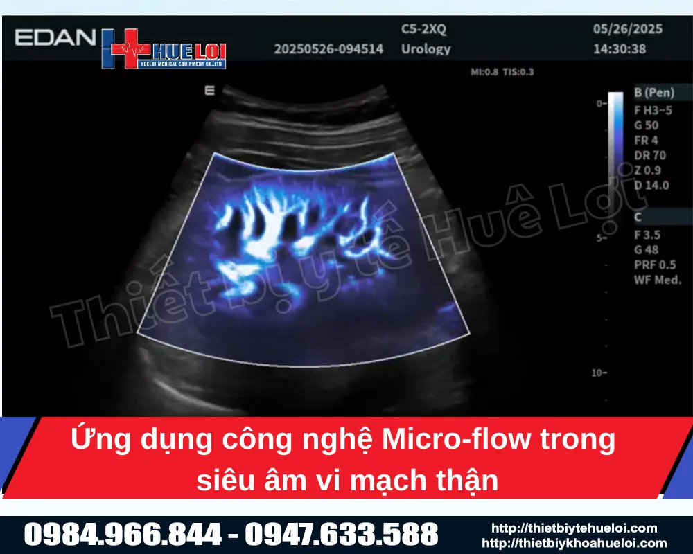 Hệ thống siêu âm tổng quát tích hợp công nghệ siêu âm vi mạch Micro Flow