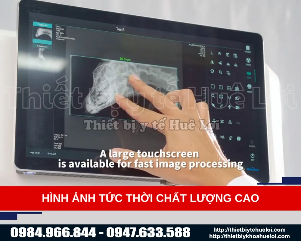 Hình ảnh chất lượng cao hiển thị trên máy X quang kỹ thuật số thú y Máy X-quang thú y cố định VX200/VX400