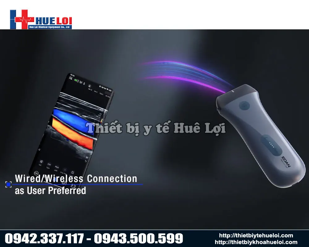 Khả năng kết nối và truyền dư liệu tuyệt vời của edan l12