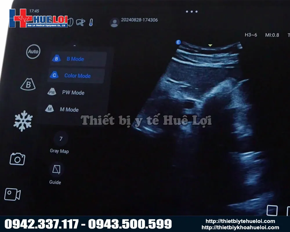 Máy siêu âm cầm tay edan nano L12 exp