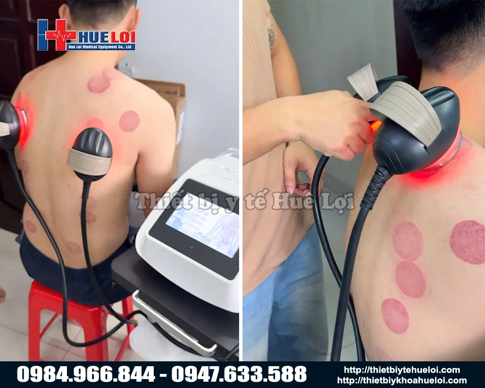 Trị liệu bằng máy điện sinh học đa năng mới nhất hiện nay