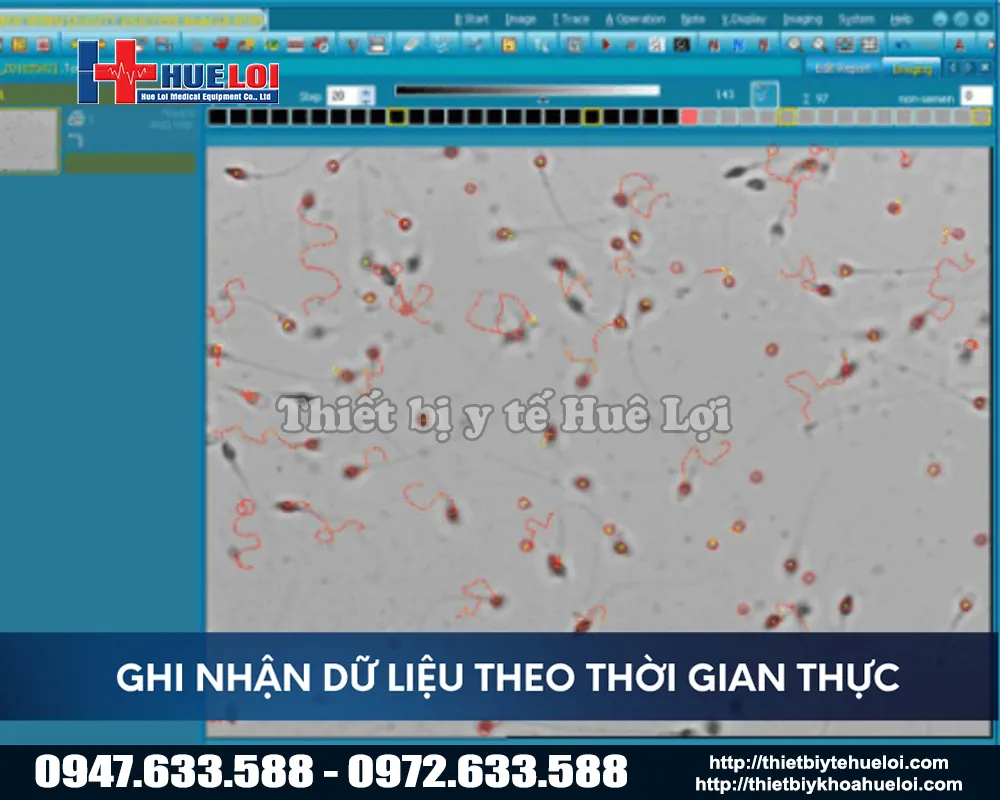 Hình ảnh phân tích tinh dịch thông qua máy phân tích dịch đồ