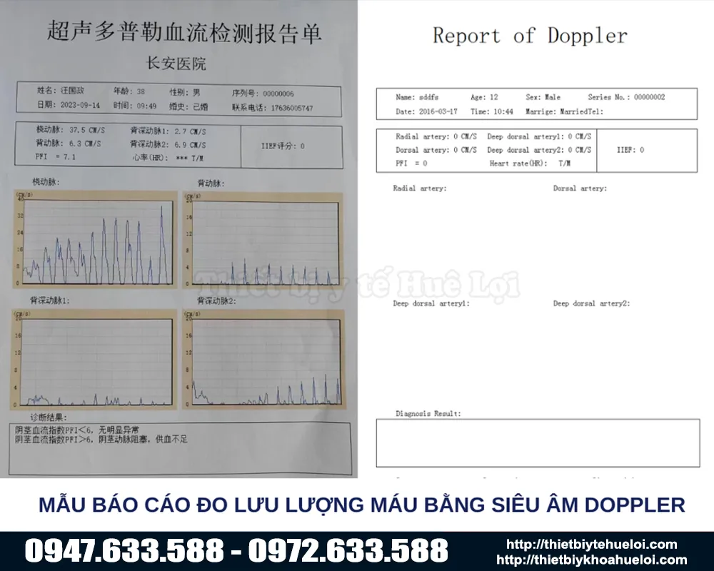 Báo cáo kết quả từ máy đo chức năng tình dục nam