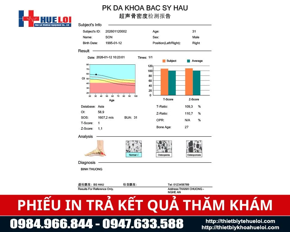 Phiếu trả kết quả đo mật độ xương của bệnh nhân