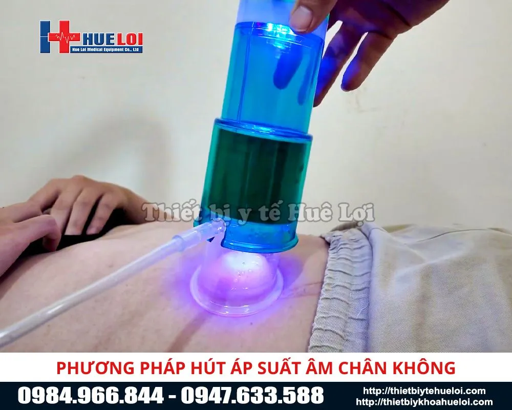 Phương pháp hút áp suất âm chân không của máy điều trị xuất tinh sớm