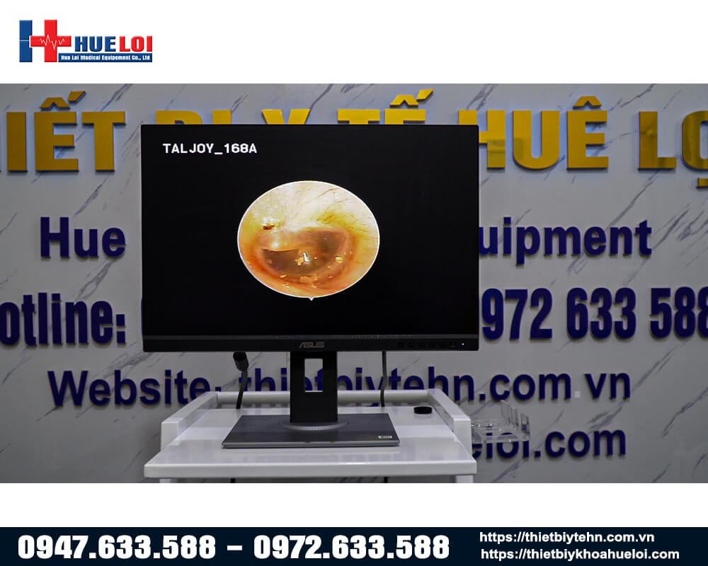 máy nội soi tai mũi họng taljoy giá rẻ