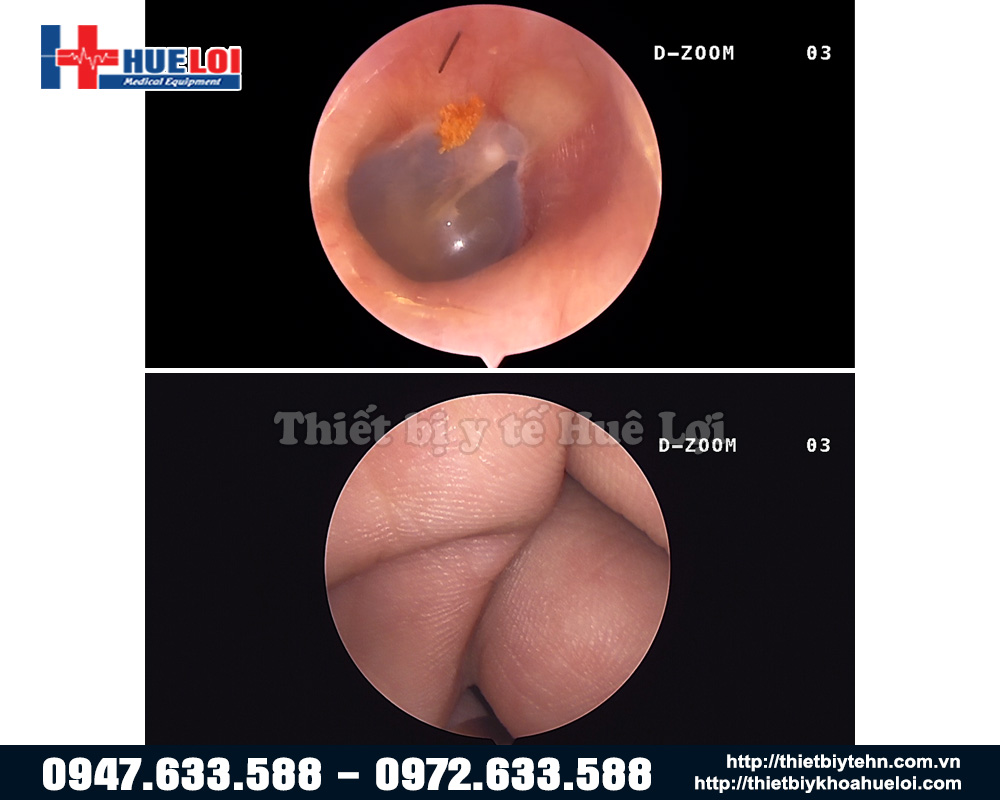 chất lượng hình ảnh máy nội soi ncm 24