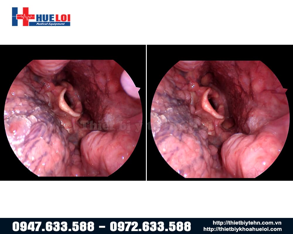 chất lượng hình ảnh