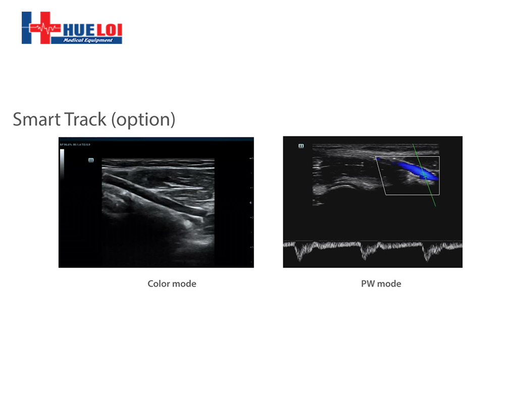 may-sieu-am-mindray-dc-40