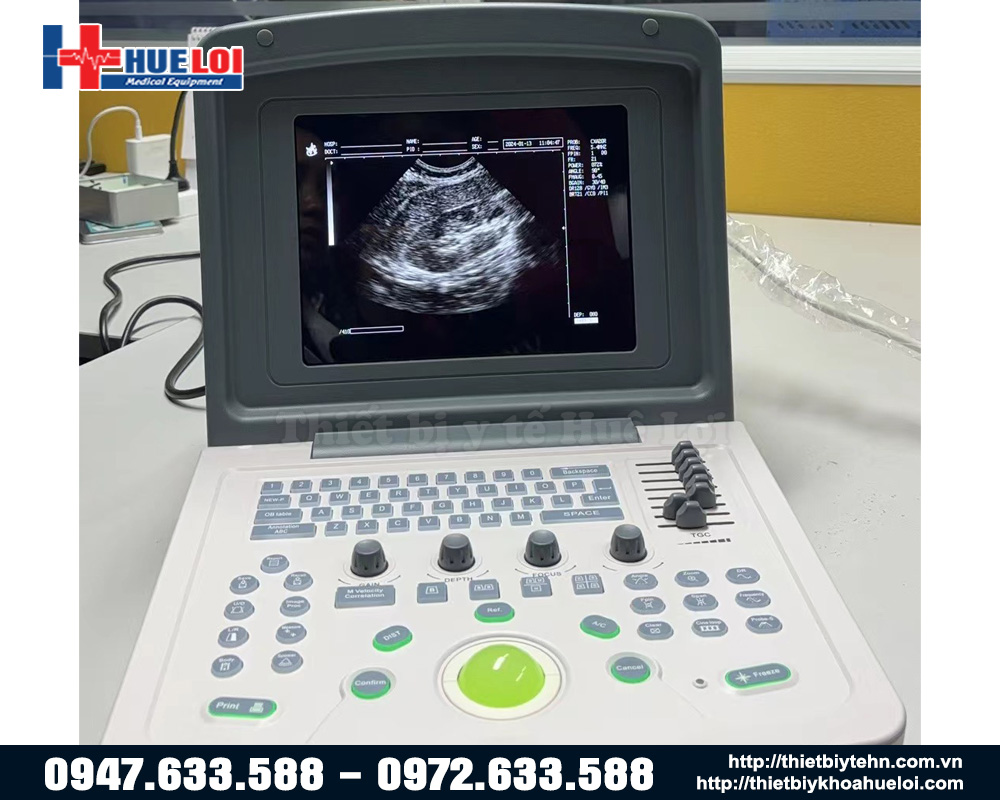 Máy siêu âm xách tay giá rẻ