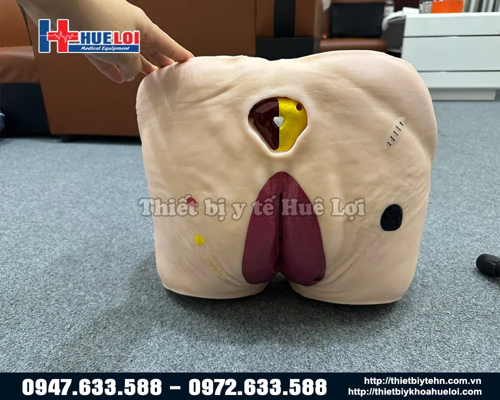 Mô hình cùng một vùng thương tổn