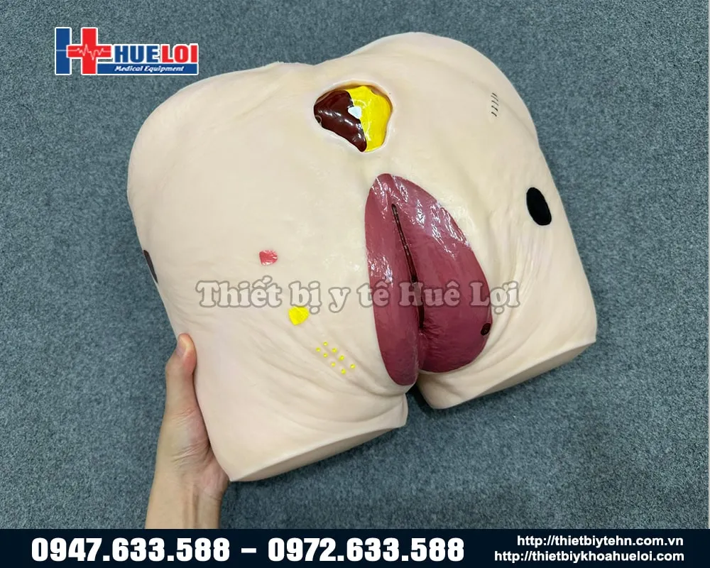 Mô hình cùng một vùng thương tổn