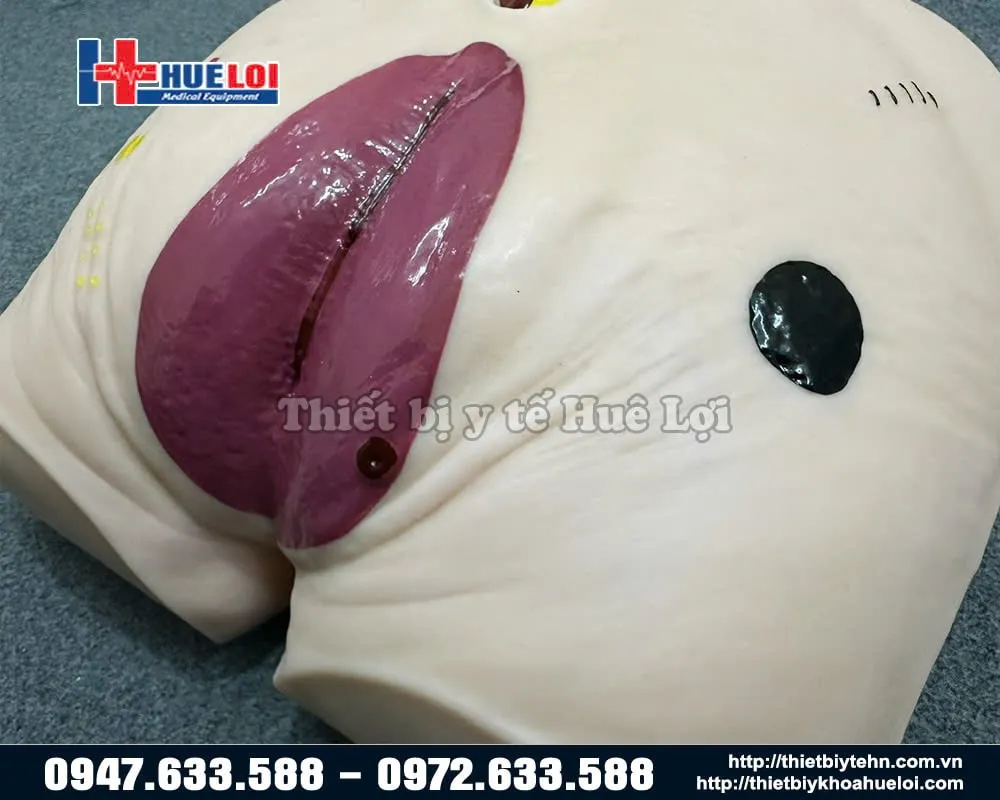 Chi tiết nấm trên mô chăm sóc vết thương cùng cụ