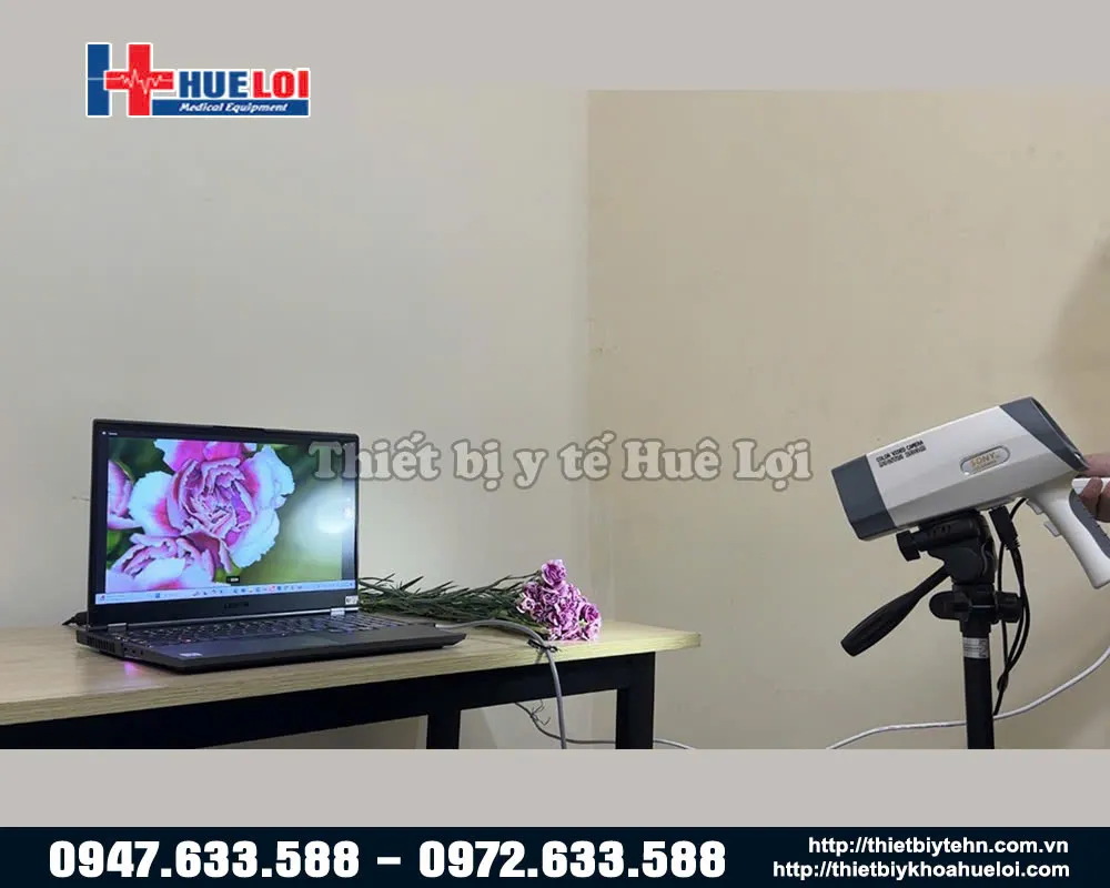 Ảnh thực tế máy soi cổ tử cung Ecocon FULL HD